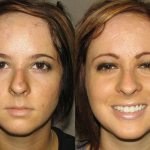 Facial Trauma Patient 1 | Guyette Facial & Oral Surgery, Scottsdale, AZ