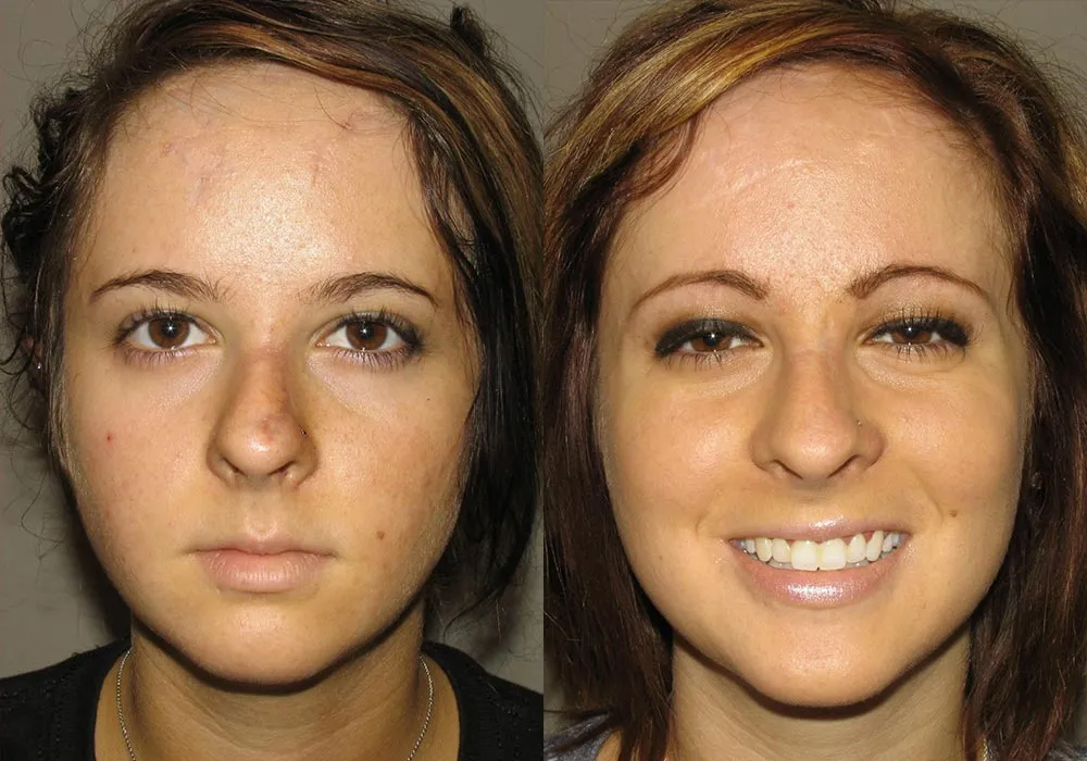 Facial Trauma Patient 1 | Guyette Facial & Oral Surgery, Scottsdale, AZ