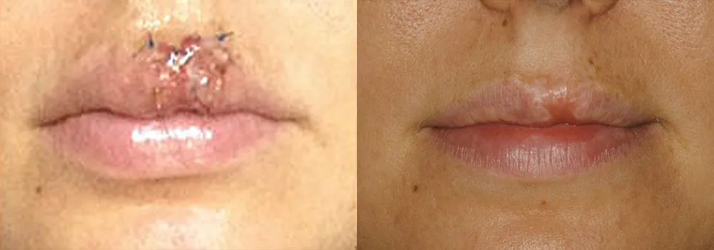 Facial Trauma Patient 2 | Guyette Facial & Oral Surgery, Scottsdale, AZ