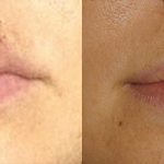 Facial Trauma Patient 2 | Guyette Facial & Oral Surgery, Scottsdale, AZ
