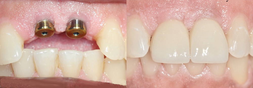 Guyette Facial & Oral Surgert | Scottsdale, Phoenx, Avondale