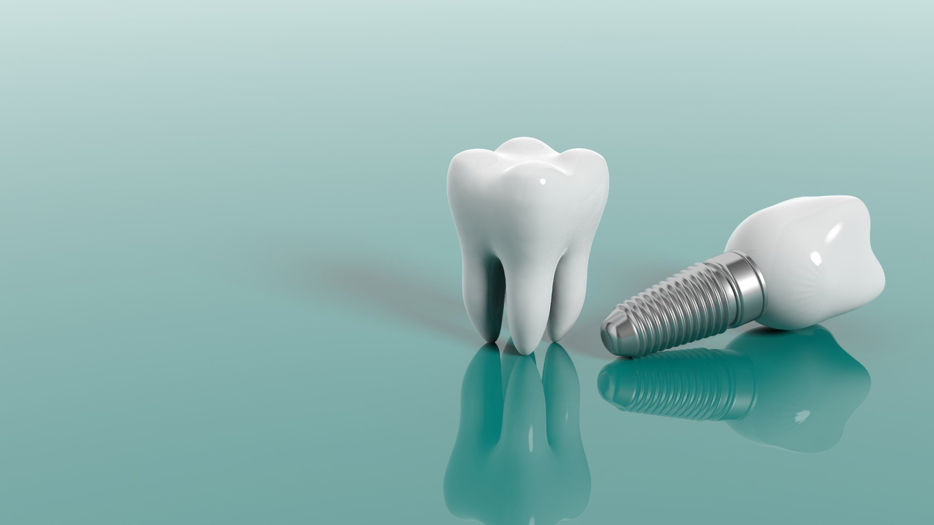 Dental Implants in Scottsdale by Guyette Oral Surgery