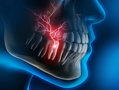 A stylizied image illustrating root and nerve pain