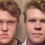 Front view of a young boy who got corrective jaw surgery in Scottsdale & Avondale, AZ