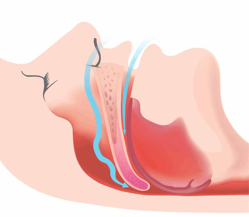 Treating Obstructive Sleep Apnea in Scottsdale & Avondale, AZ